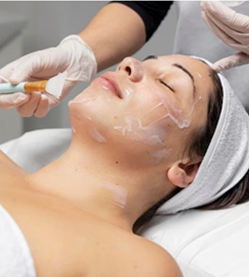 Peeling Químico (Europeu)